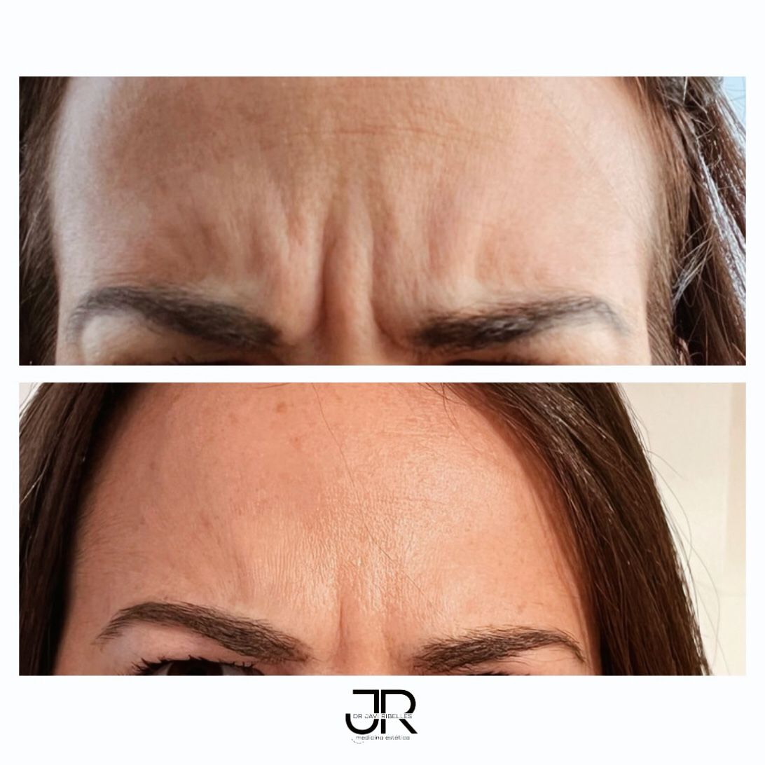 Javier Ribelles Alfonso-36