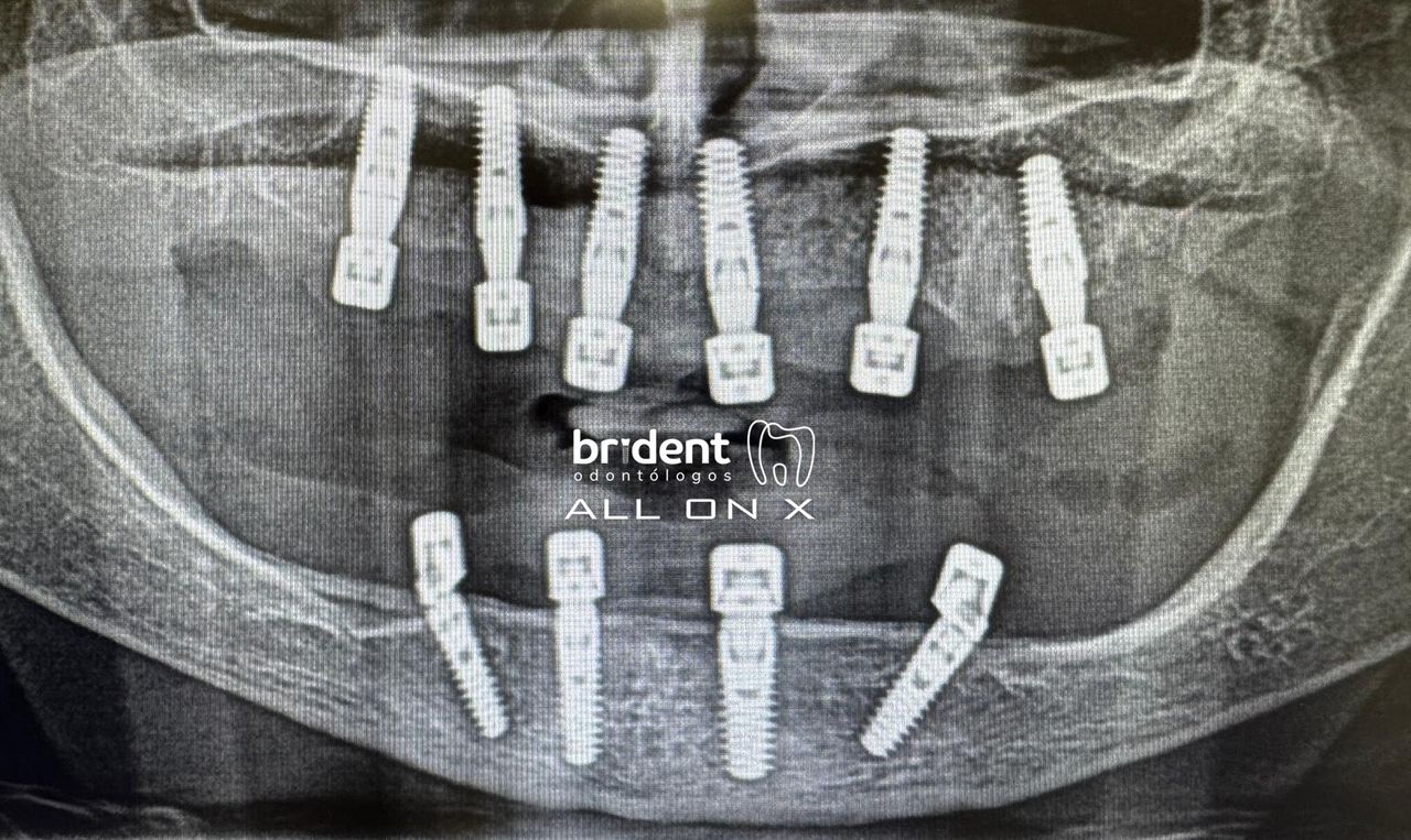 Guillermo Moreno Masiá-49