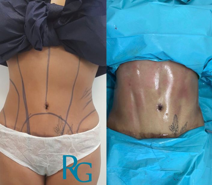 Rafael Gonzalez Oñate-15