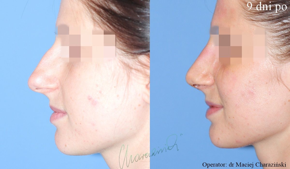 Maciej Charaziński-23