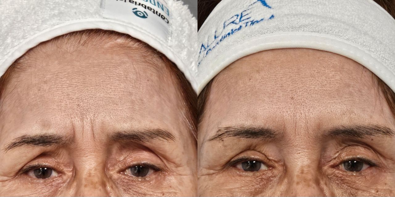 Rosalba Herrero Zerpa-566