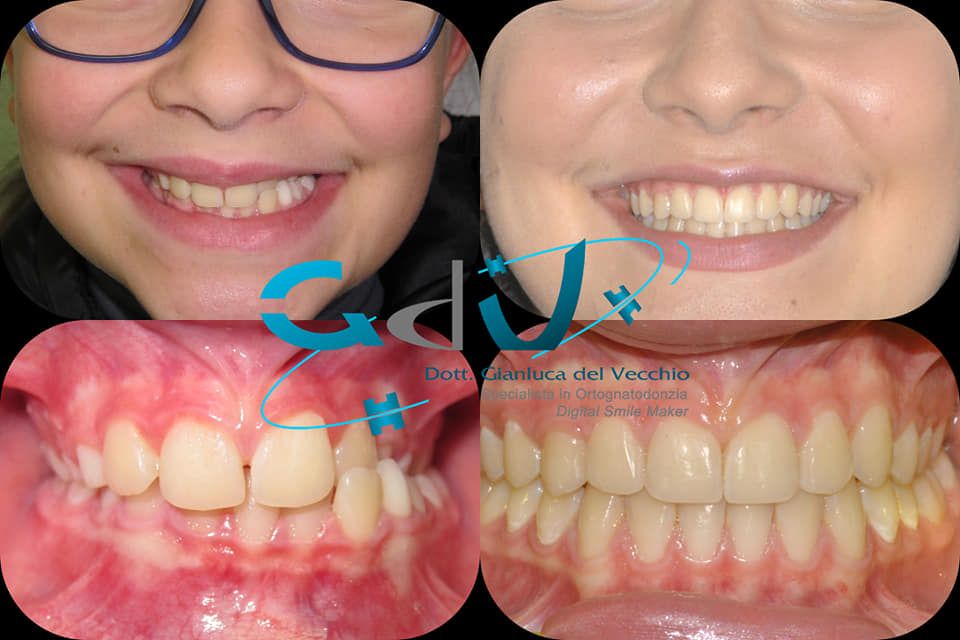 Gianluca Del Vecchio-148