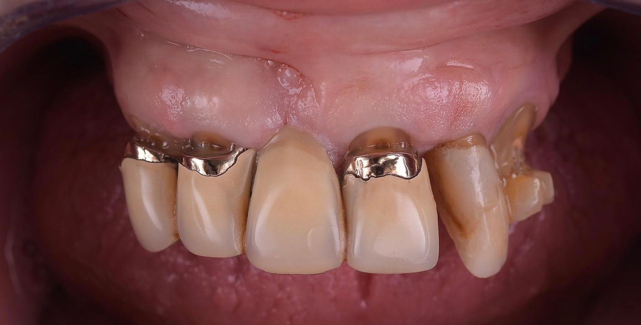 Riccardo Giardina-39