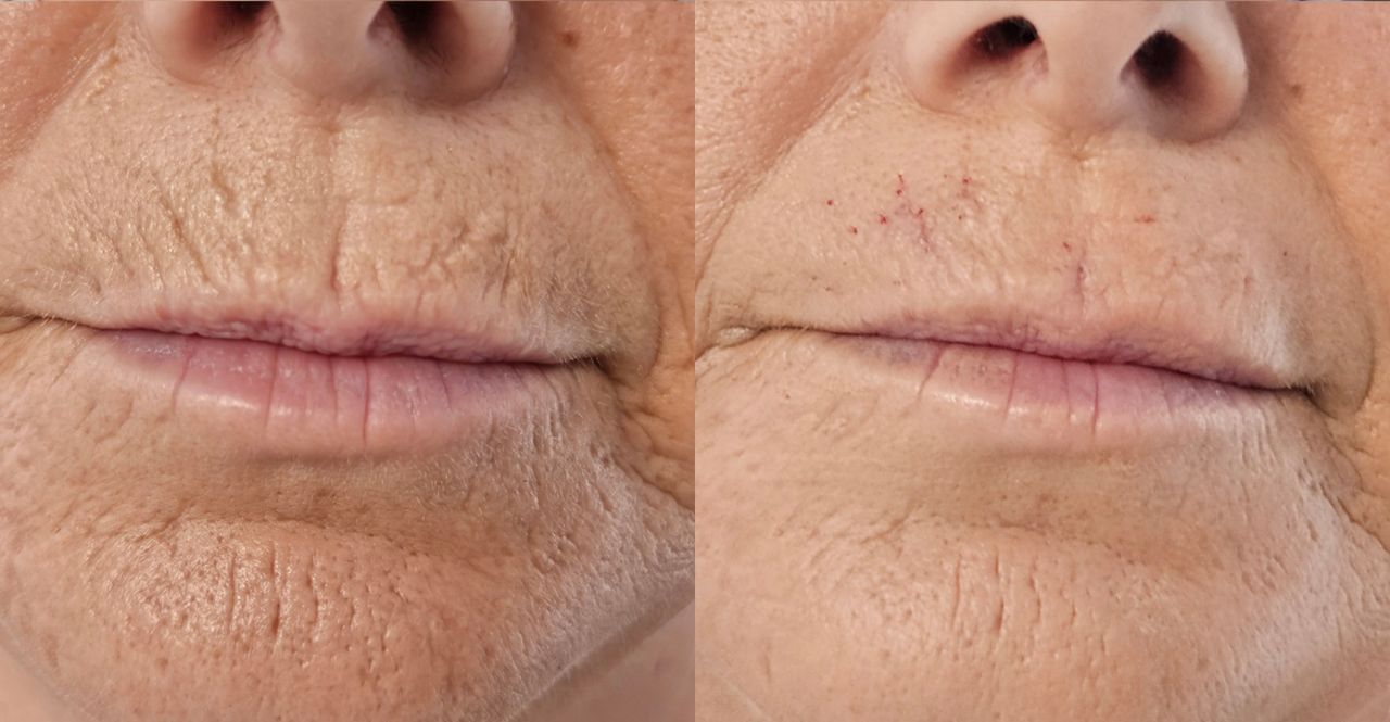 Rosalba Herrero Zerpa-461