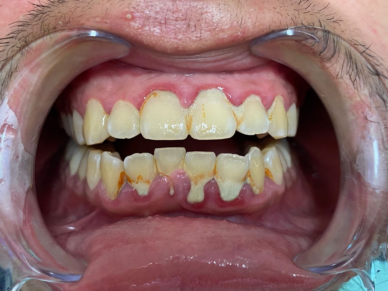 Riunito Dentista Dentalpar-17