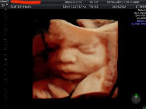 José Antonio Navarro Repiso-4