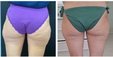 Silvia Melania Baio-13