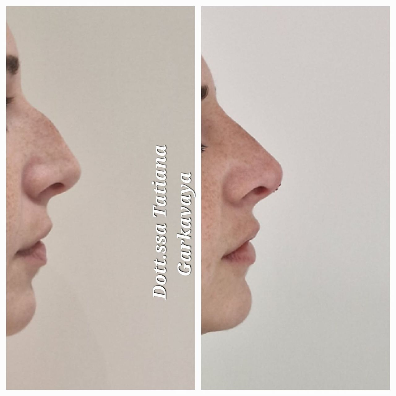 Tatiana Garkavaya-17