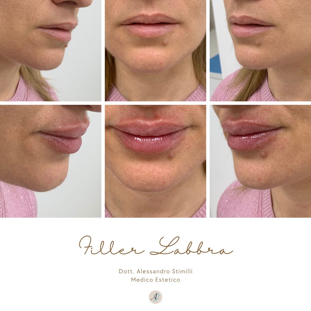 Alessandro Stimilli-9