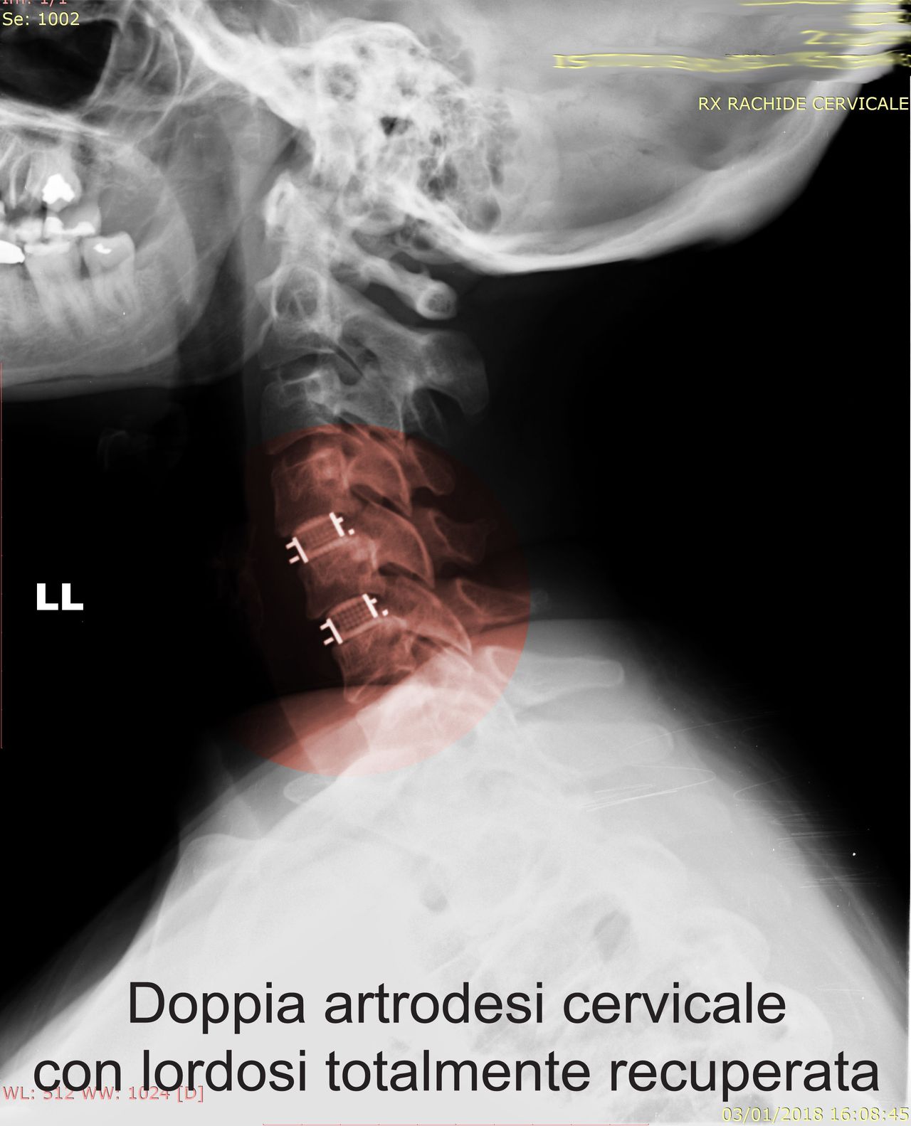 Massimiliano Neroni-12