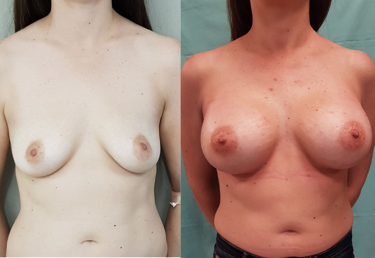 Enrique Bonanad Fernandez-12