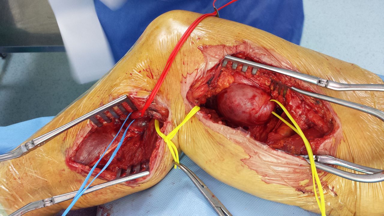 Francesco De Santis-14