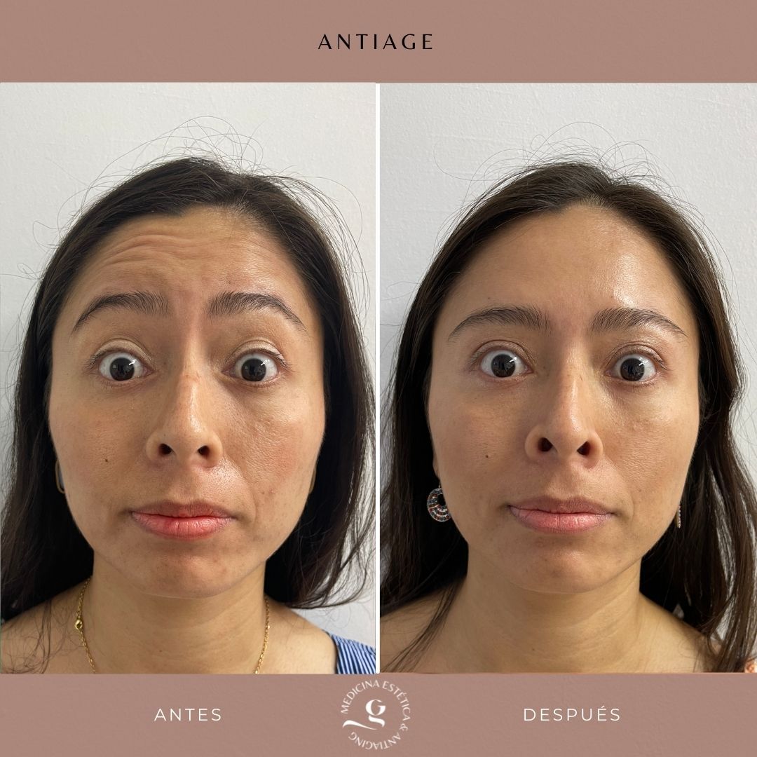 ​Giovanni Giorgianni-24