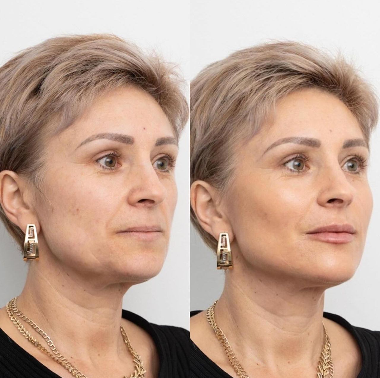 Raquel Moreno Pentinel-80