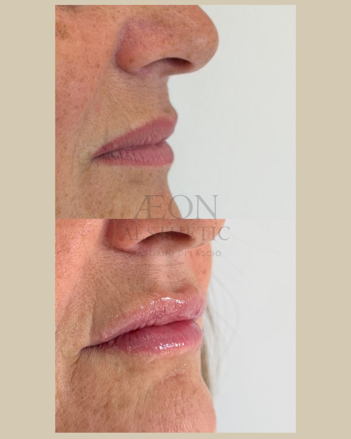 Sebastiano Di Lascio-11