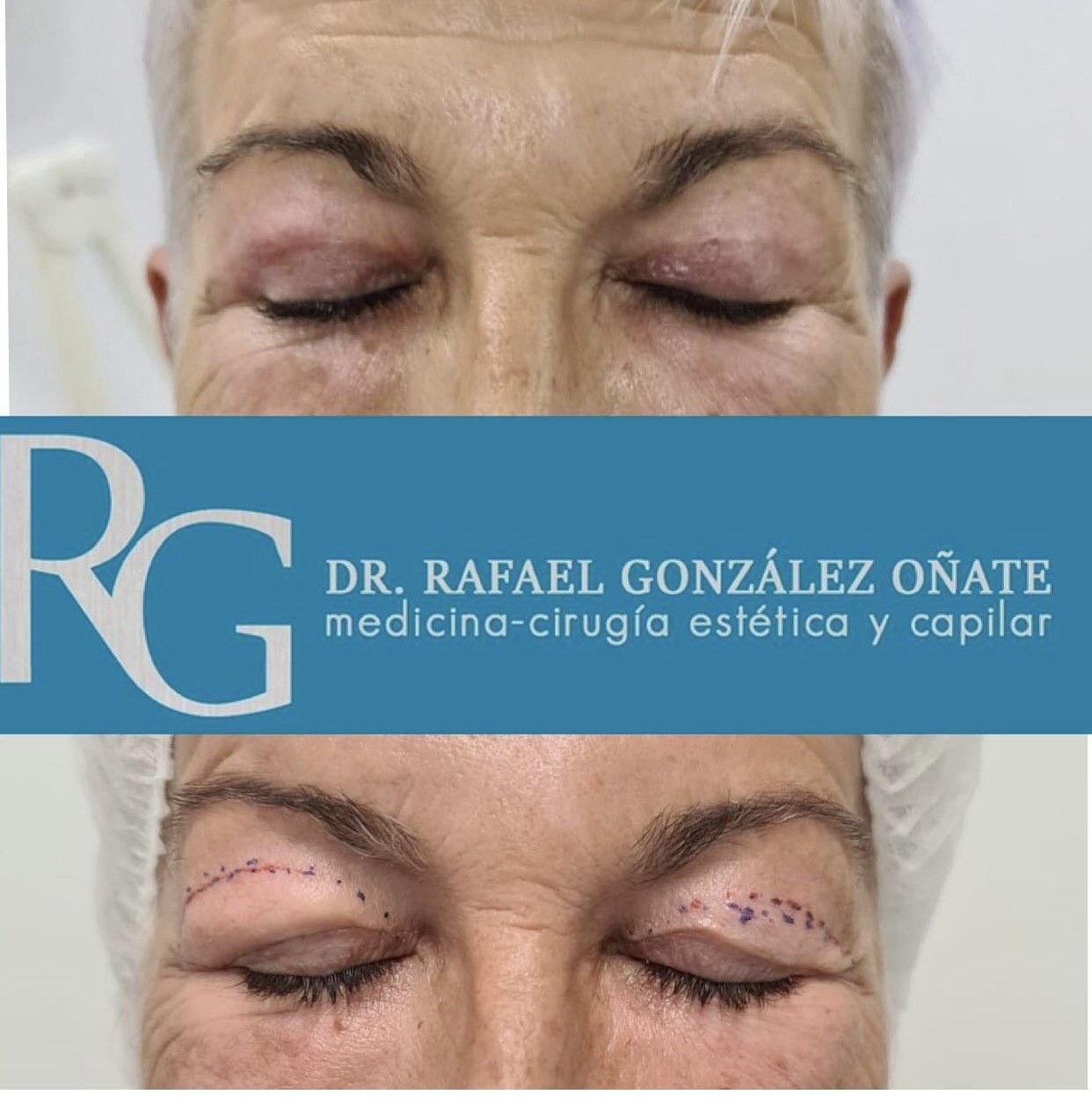 Rafael Gonzalez Oñate-5