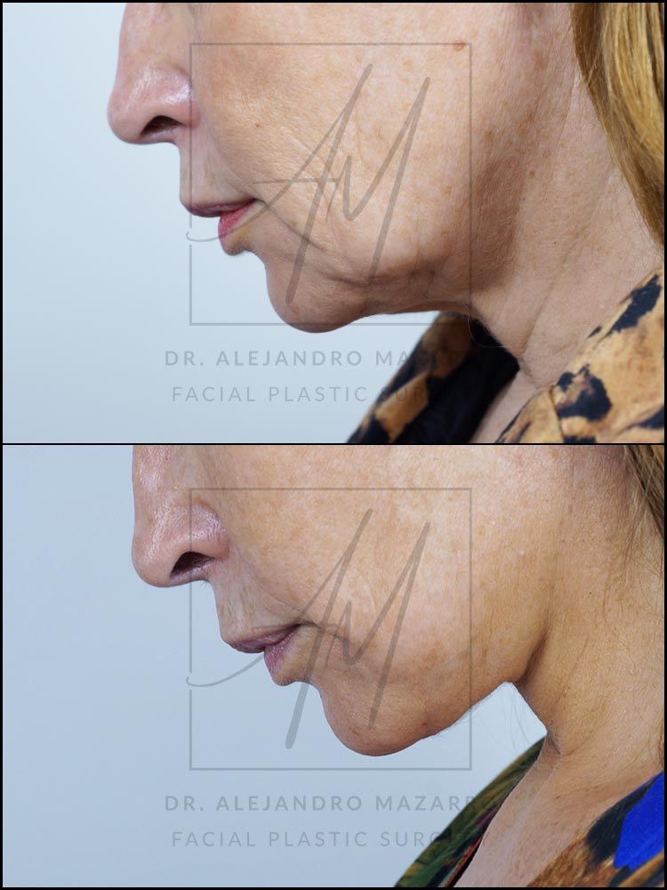 Alejandro Mazarro Campos-12