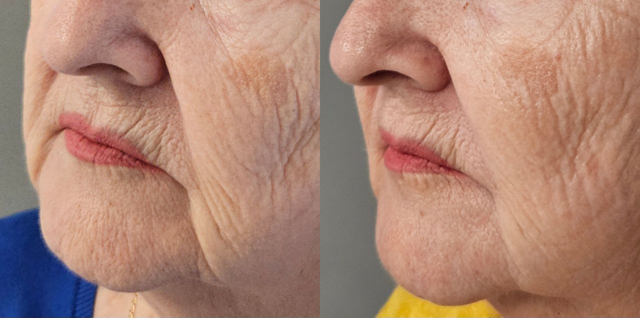 Rosalba Herrero Zerpa-43