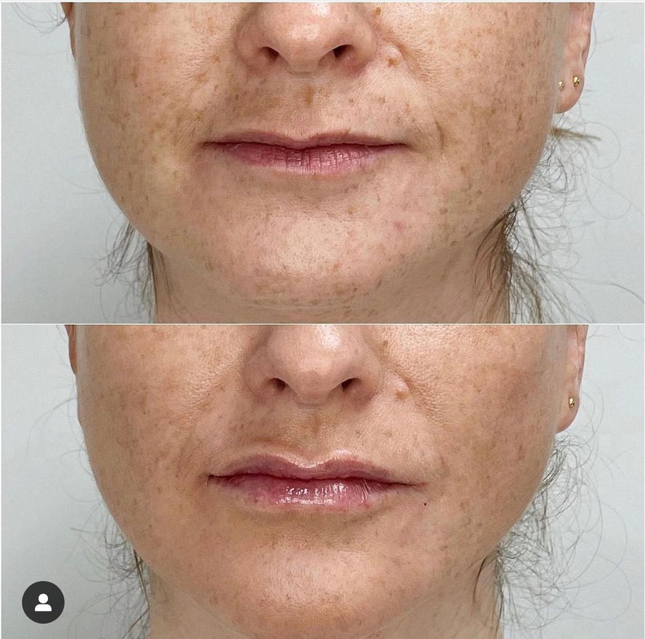 Raquel Moreno Pentinel-74