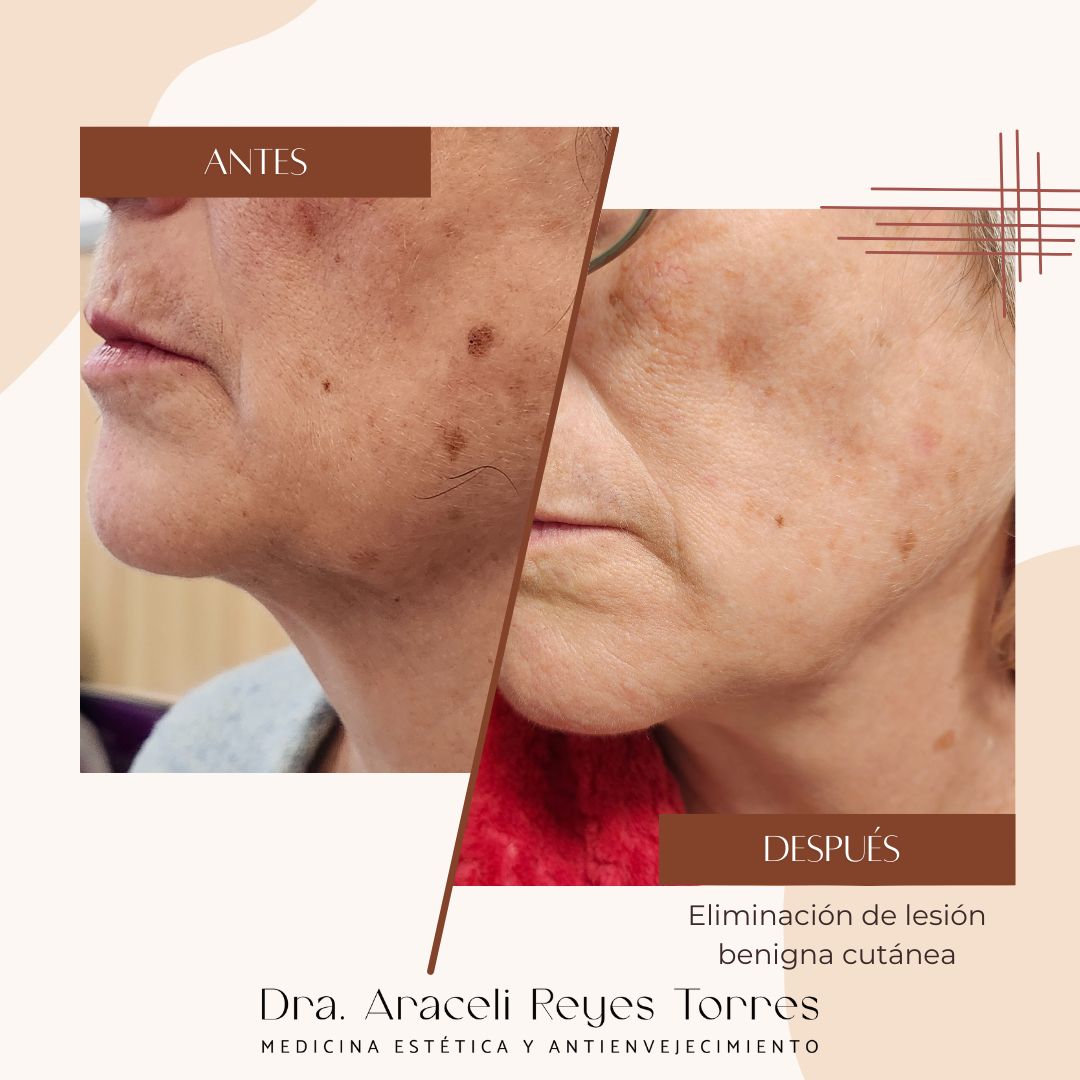 Araceli Reyes Torres-0