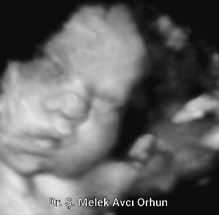 Şahver Melek Avcı Orhun-5