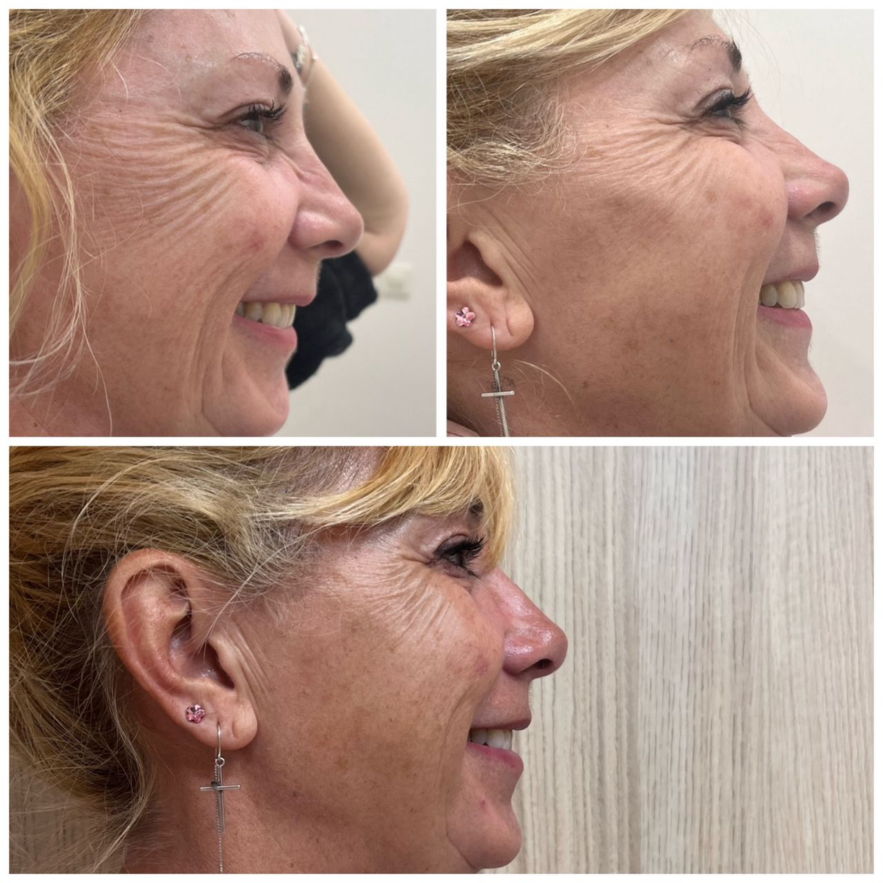 Alina Zurita Estarrona-3