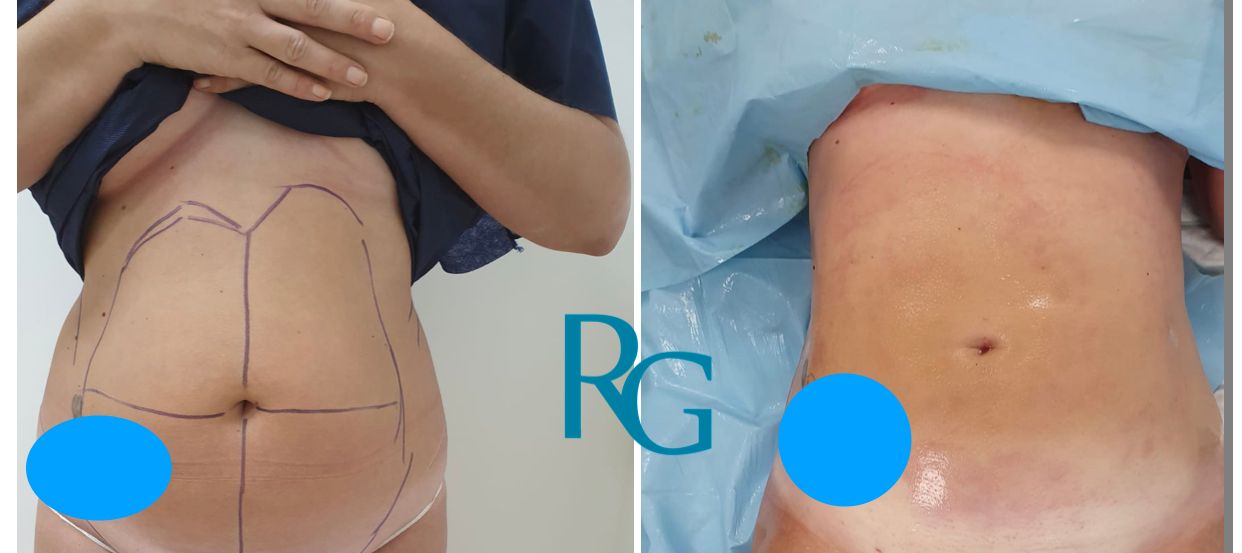 Rafael Gonzalez Oñate-13