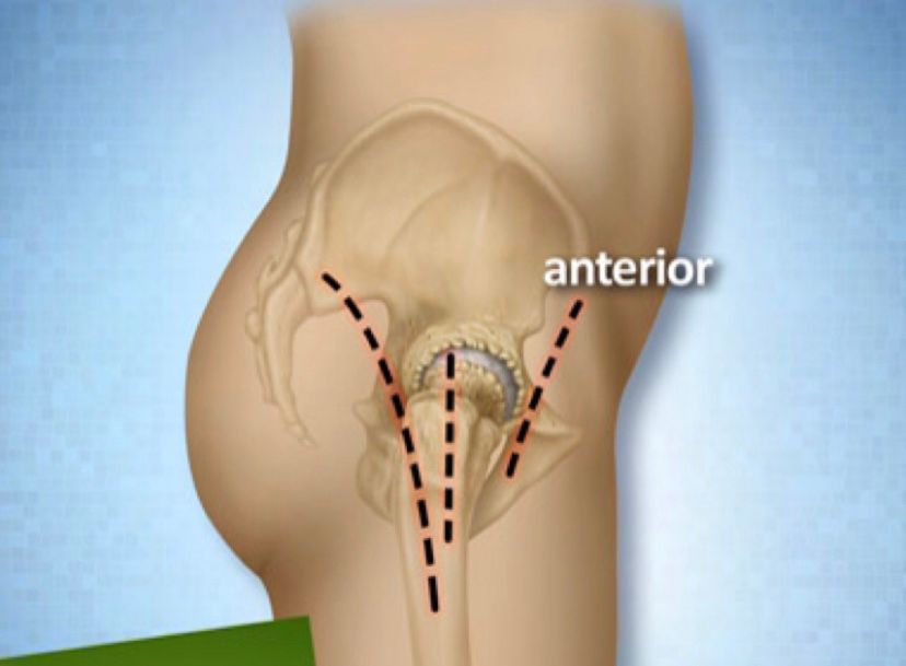 Pierpaolo Santoro-13