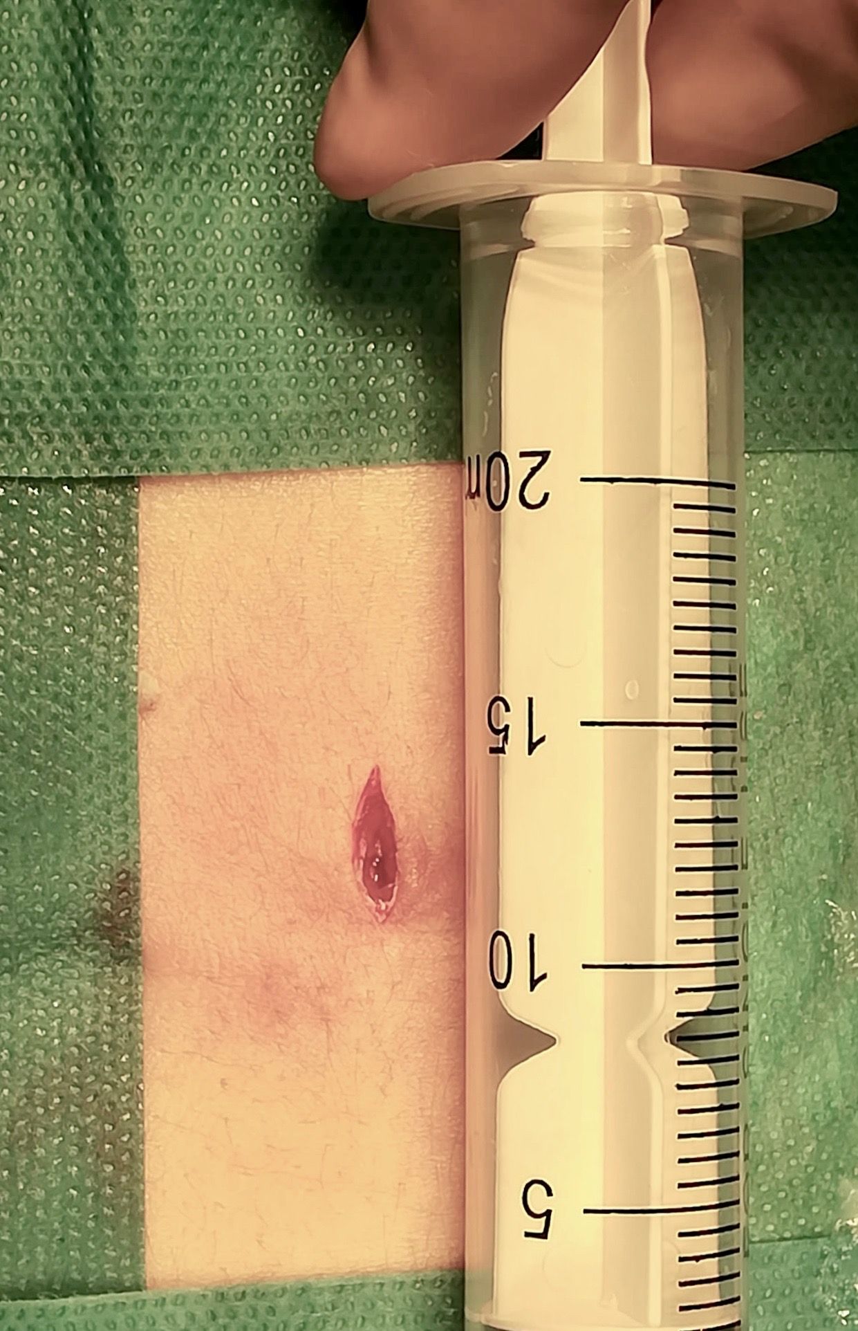 Juan Camilo Hernandez Acevedo-12