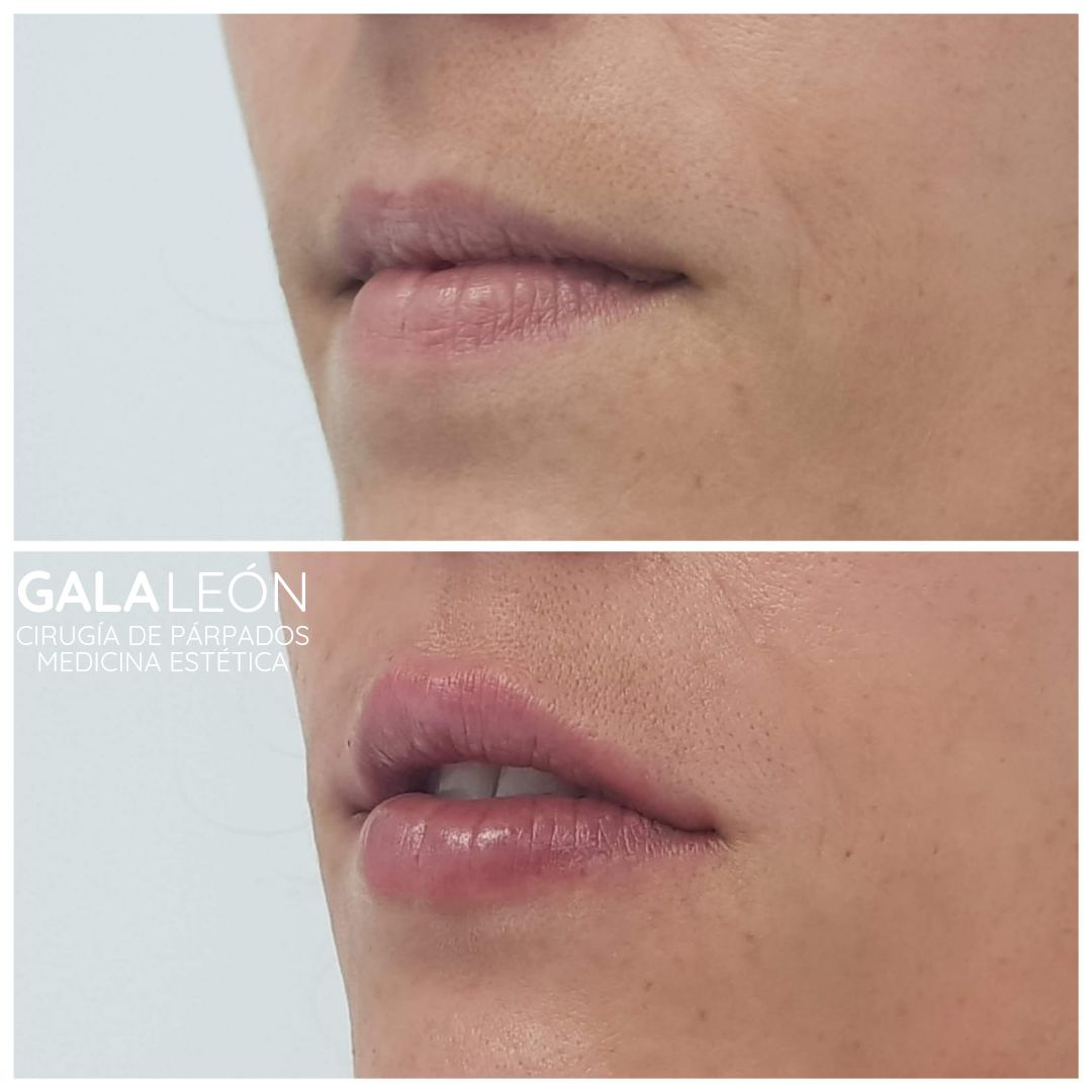 Gala P. Leon Salvatierra-9