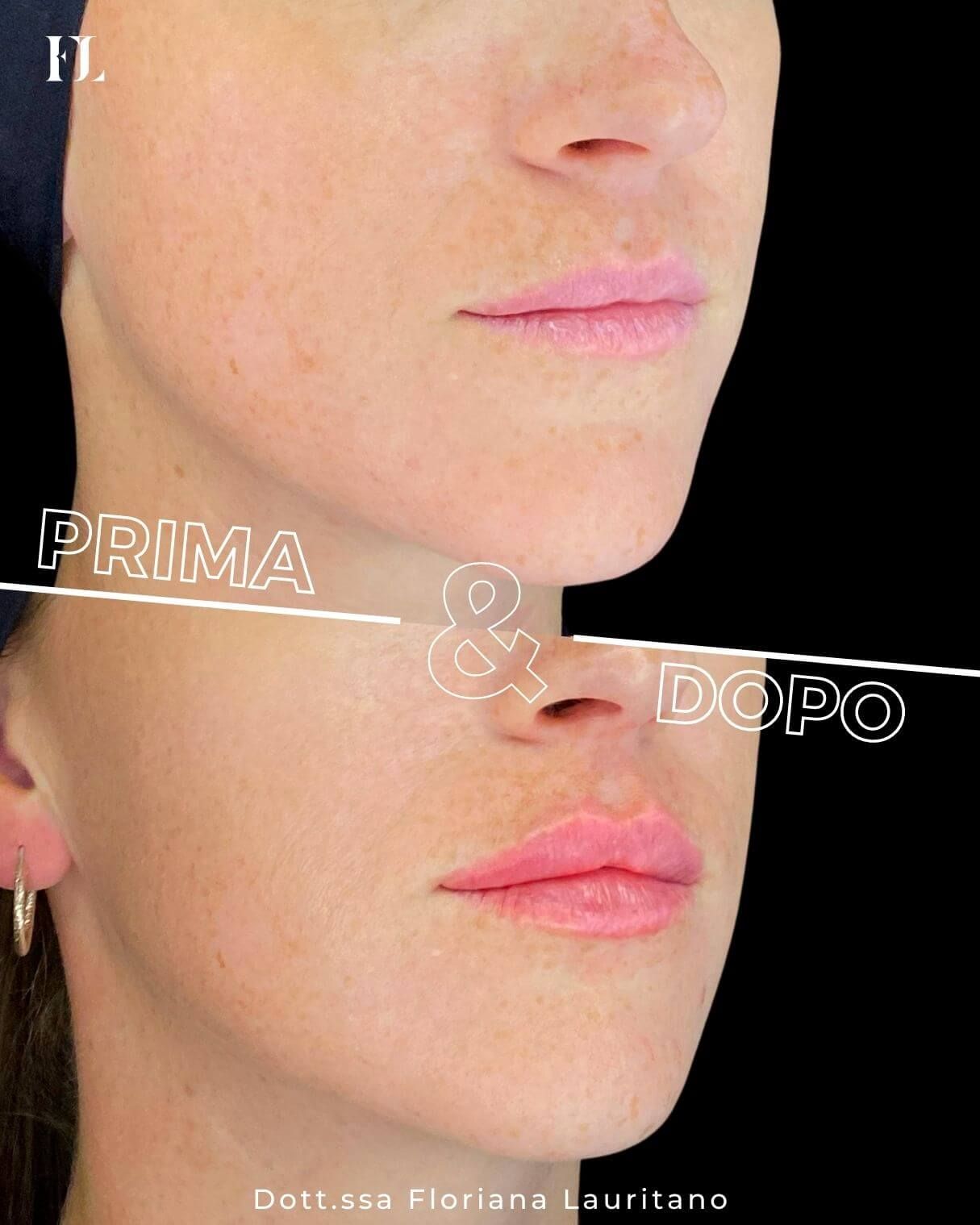 Floriana Lauritano-16