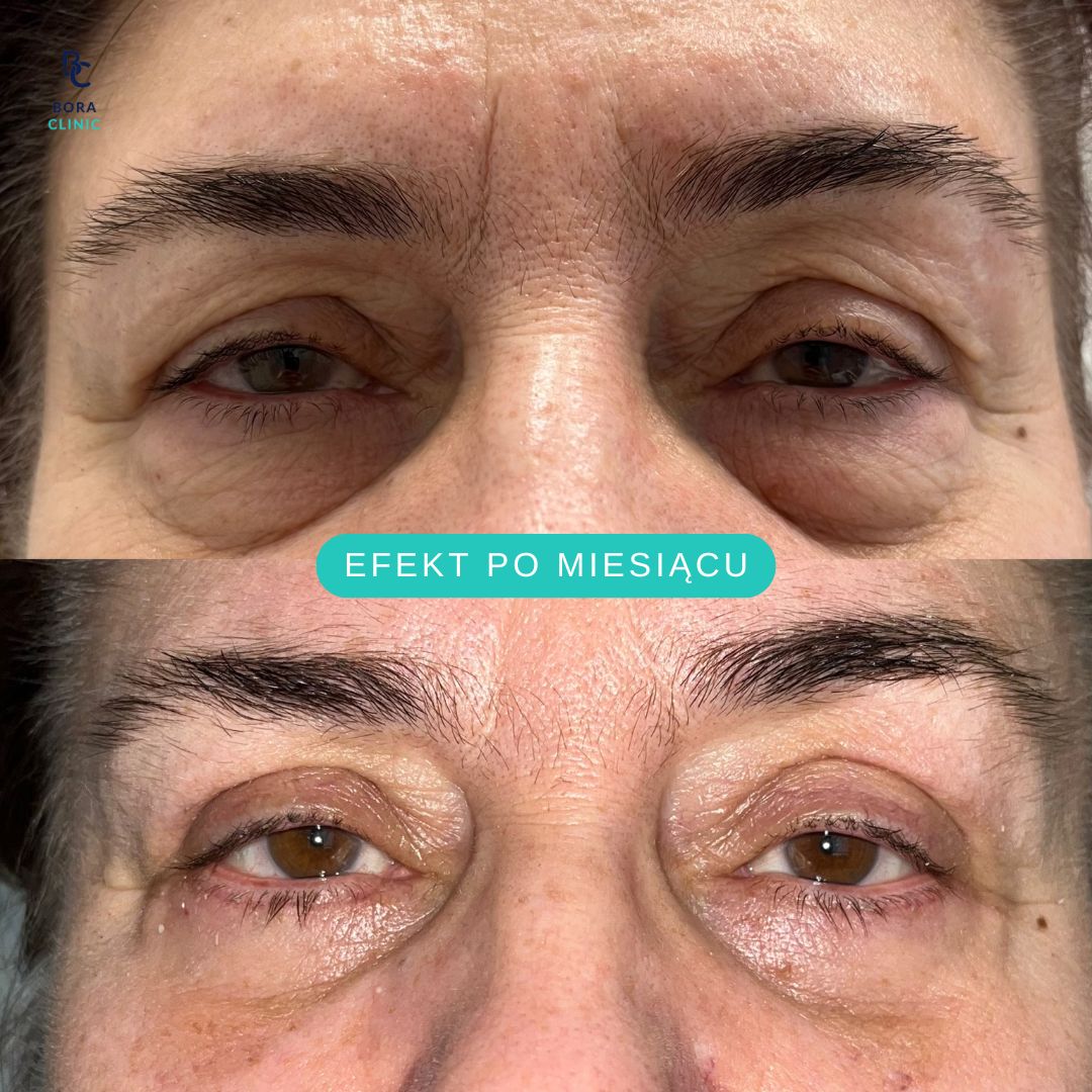 Anastasiia Grechyshkina-10