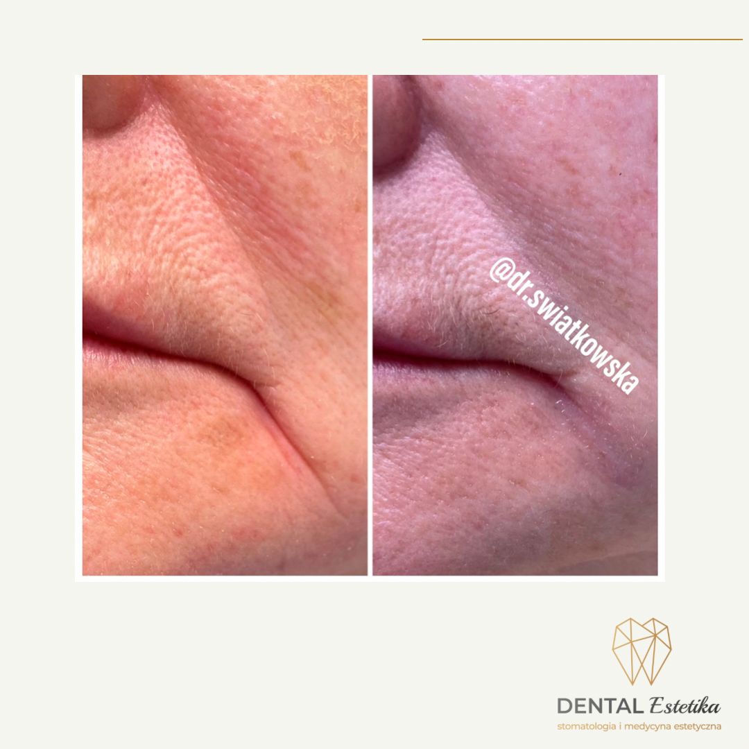 Angelika Świątkowska-26