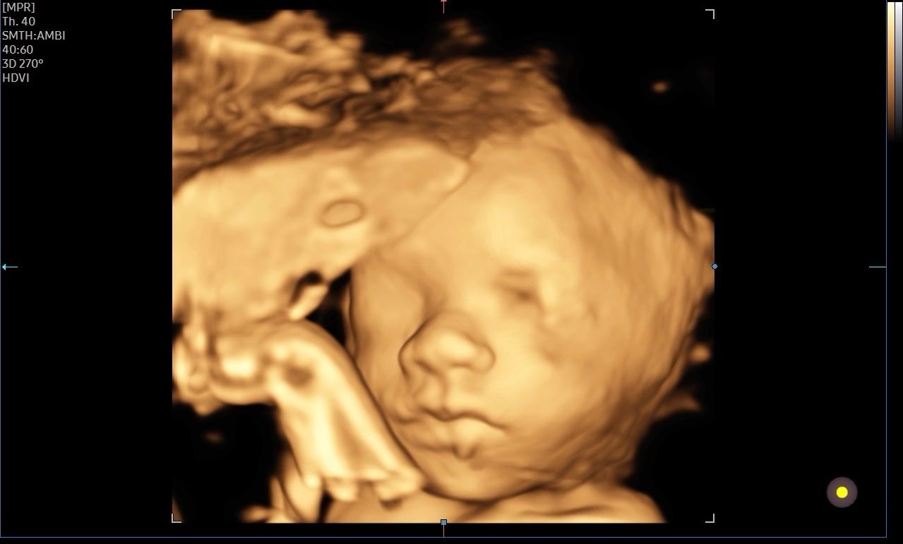 Valentina Del Negro-11