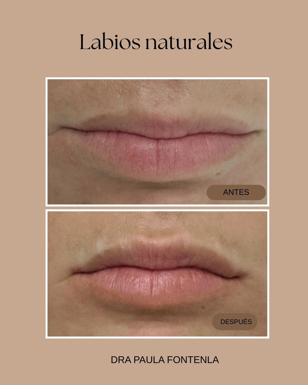 Paula Fontenla Seco-16