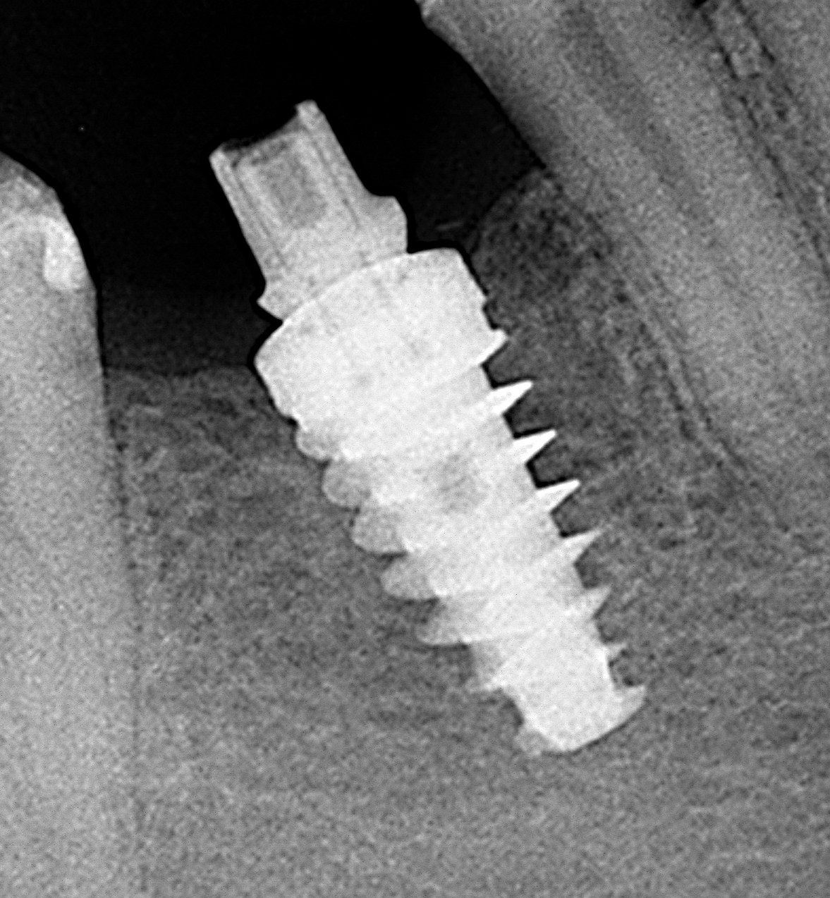 Krzysztof Zieliński-17