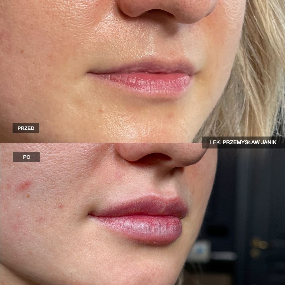 Przemysław Janik-50