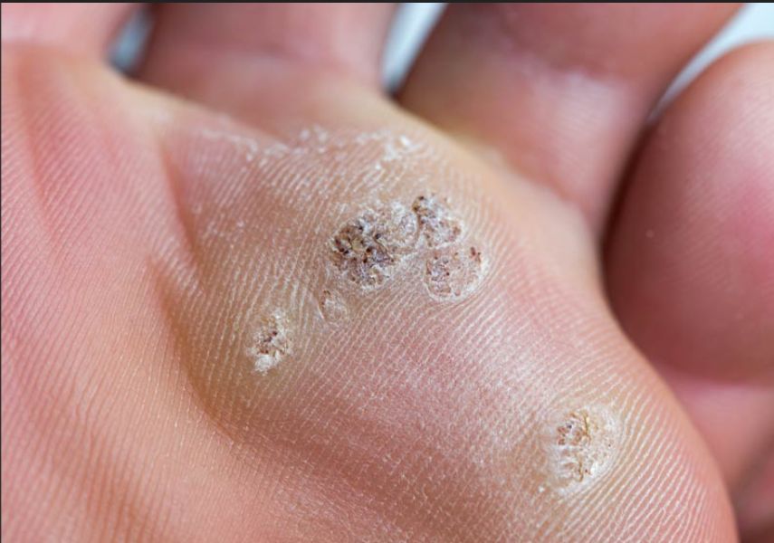 Francesca Montaquila-16