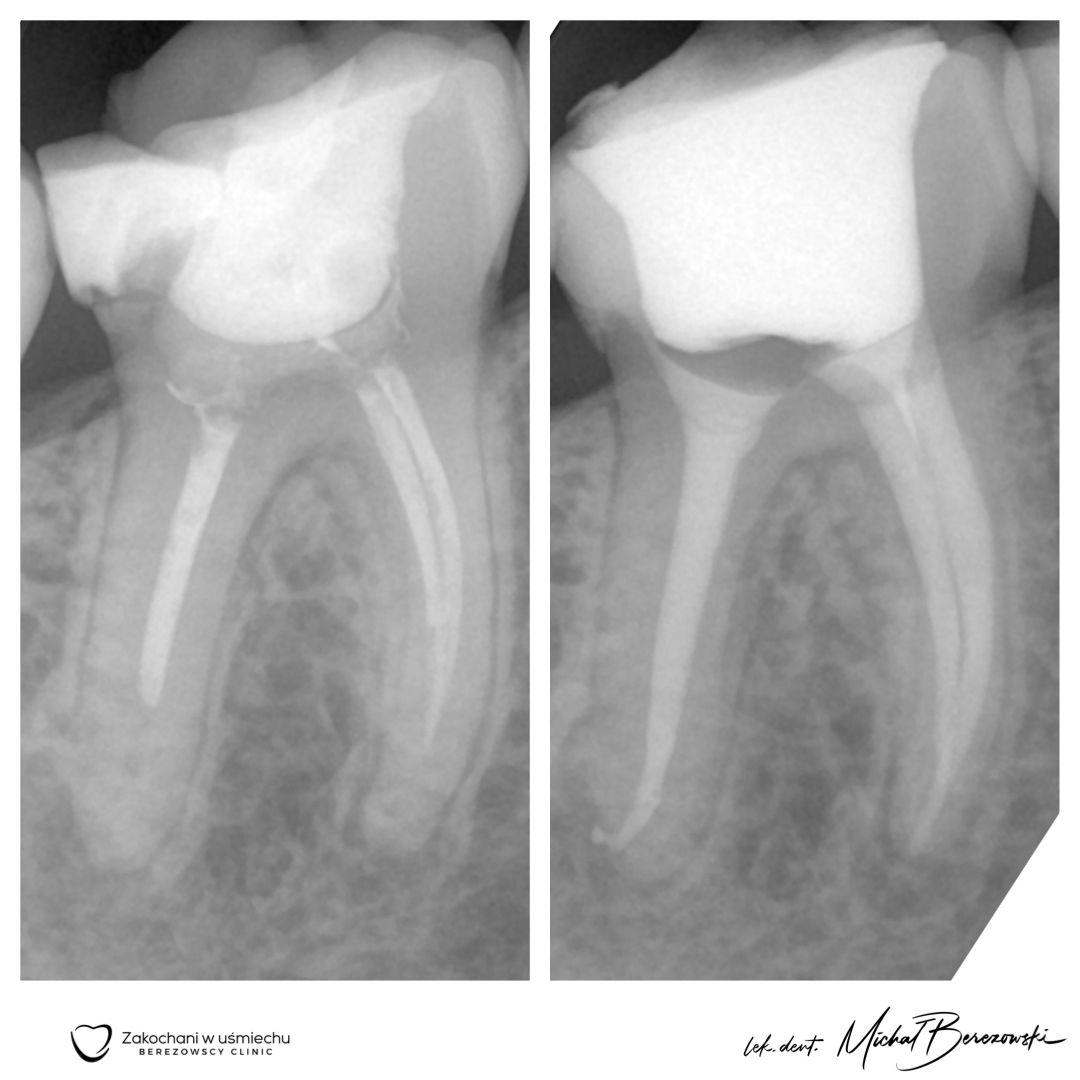 Michał Berezowski-13