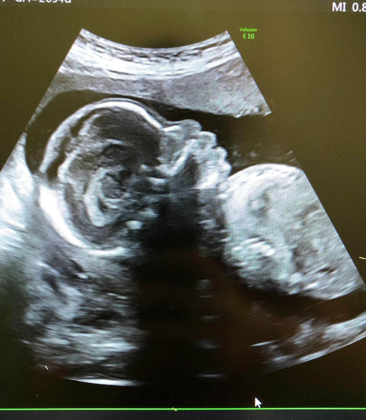 Viviana Lo Presti-11