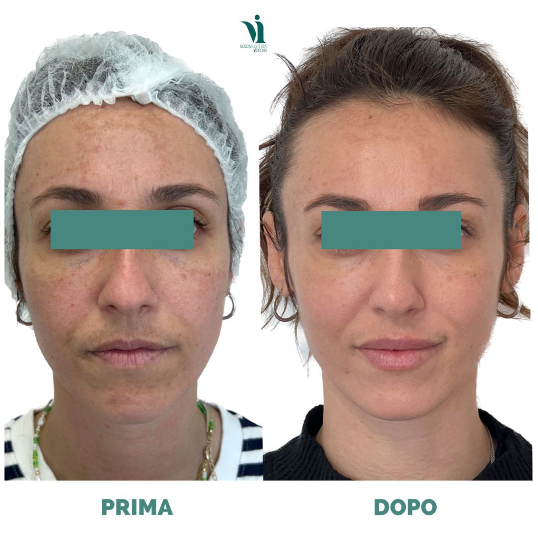 Annalisa Visicchio-1