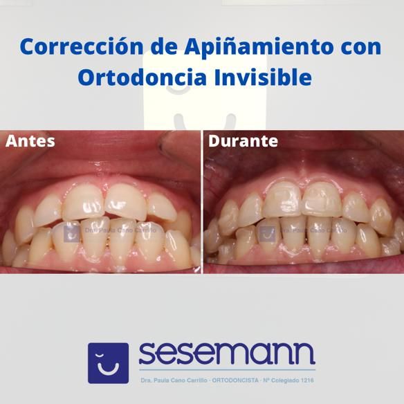 Paula Cano Carrillo-52