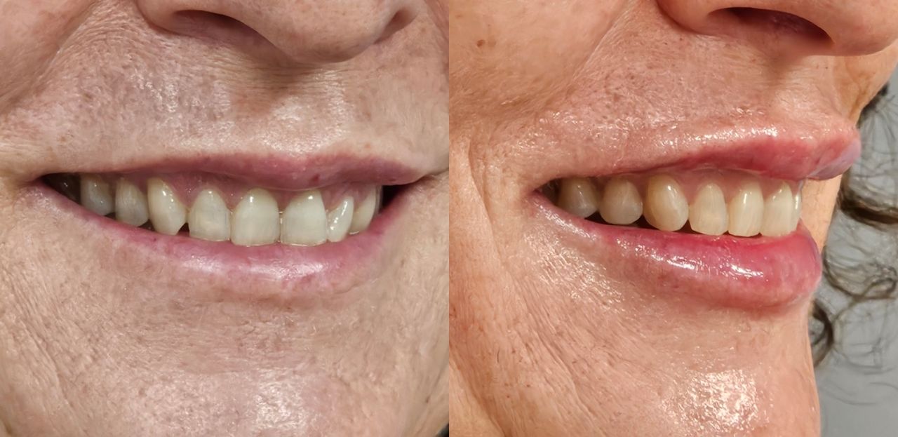 Rosalba Herrero Zerpa-586