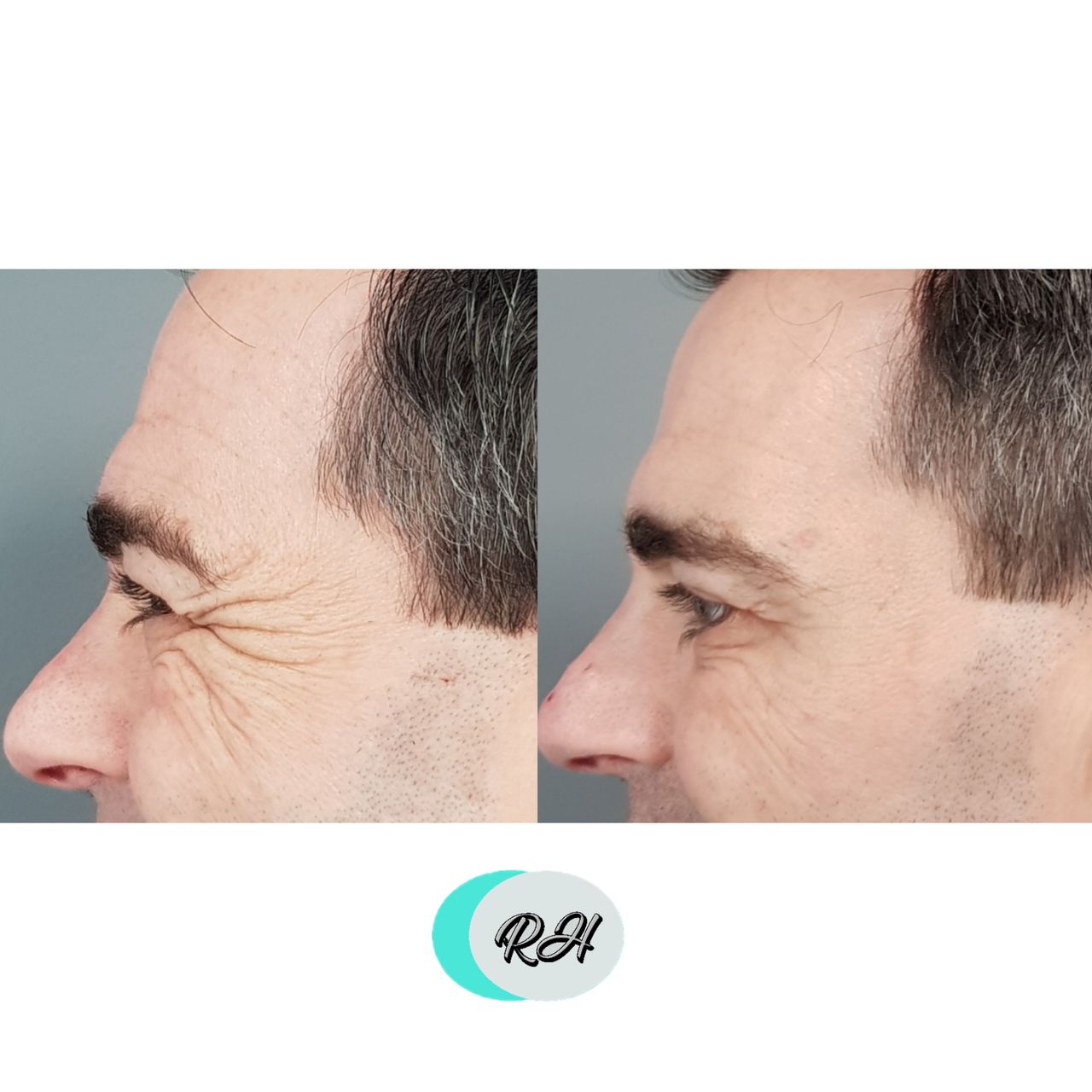 Rosalba Herrero Zerpa-178