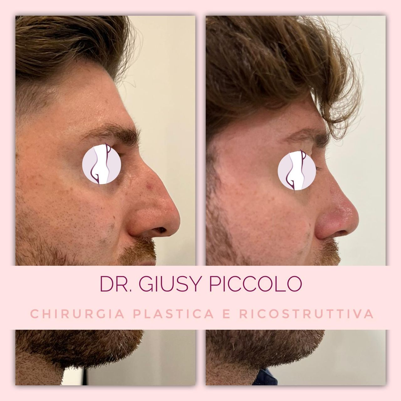 Giuseppina Piccolo-13