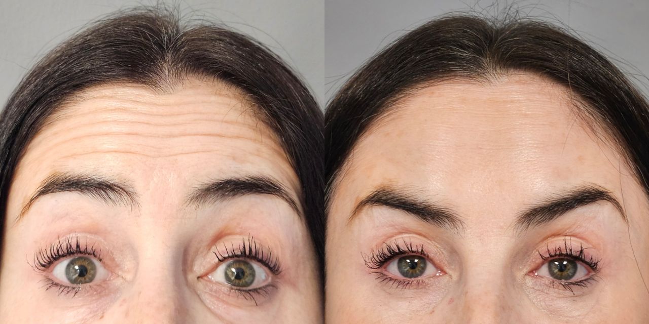 Rosalba Herrero Zerpa-24