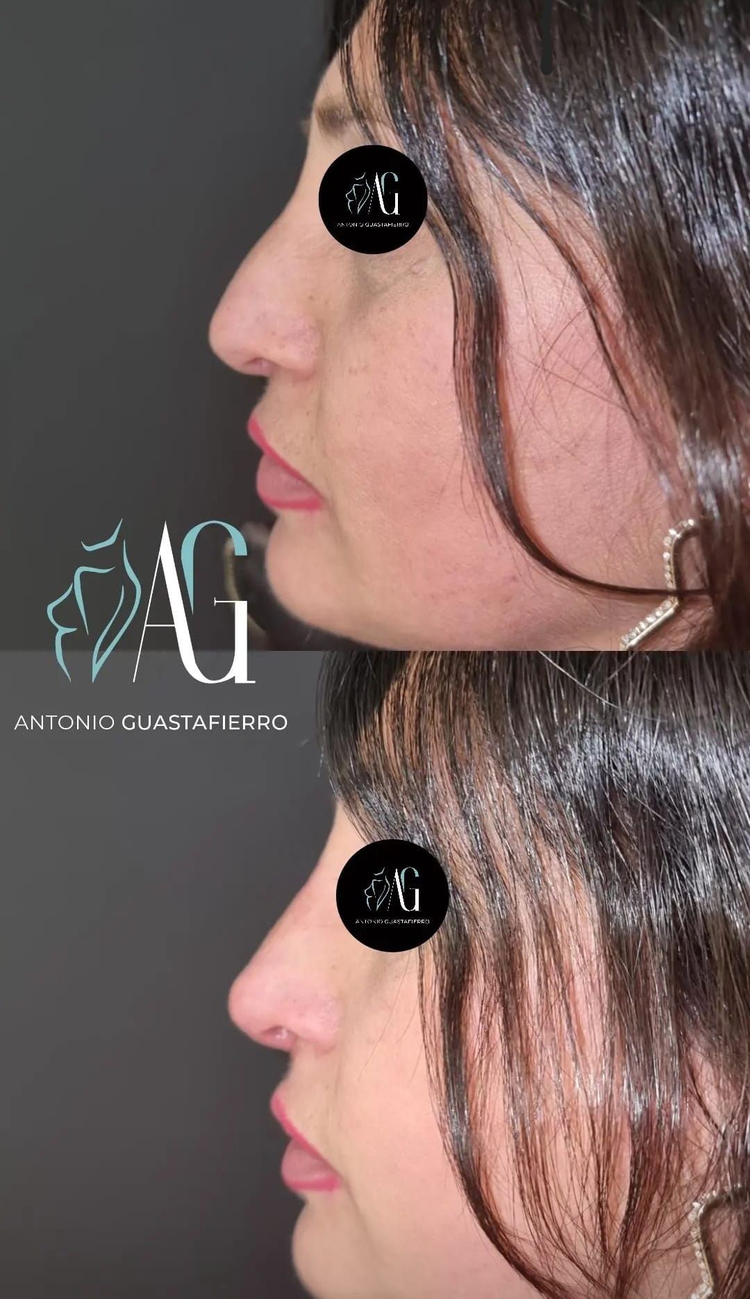 Antonio Guastafierro-6