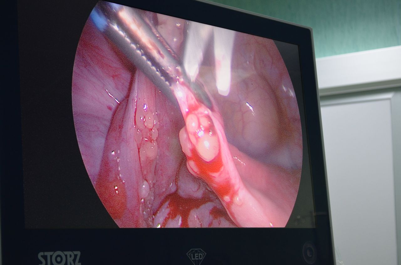 Giovanni Bracchitta-5