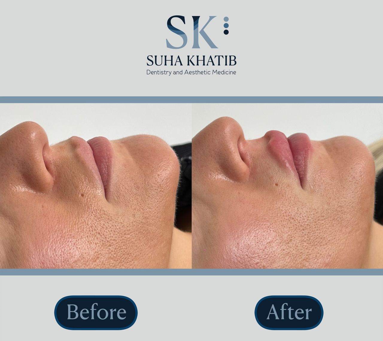 Suha Khatib-1