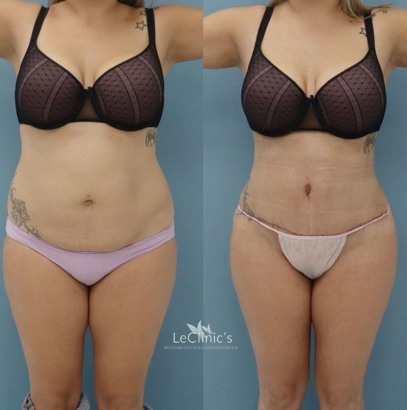 Carlos Corrales Benítez-8